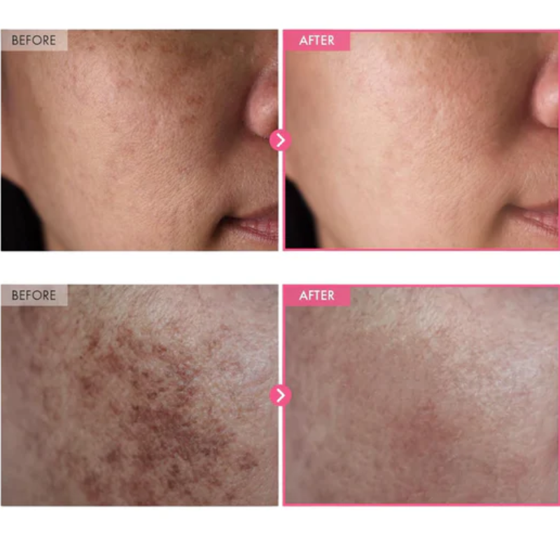 4. Fades Dark Spots & Old Scars