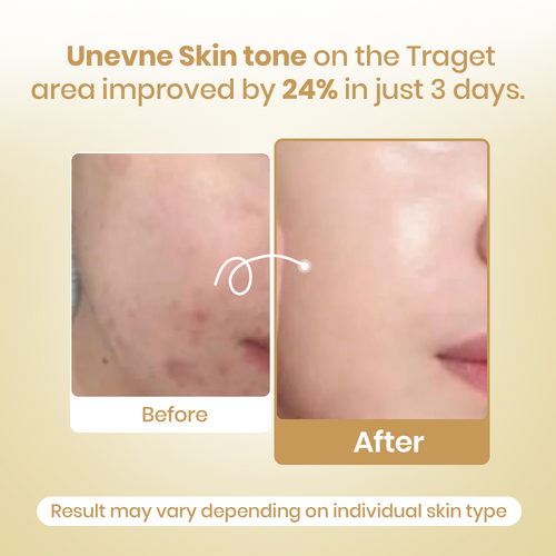 Kojic Acid Turmeric Mask